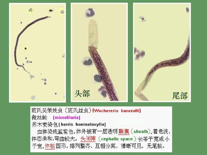 丝虫ppt