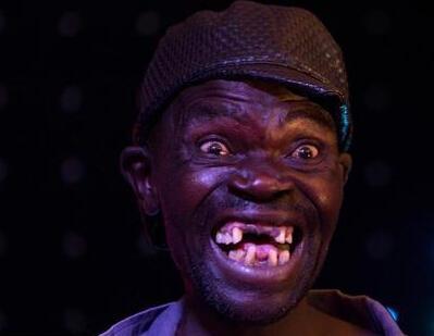 选丑比赛男子凭一口烂牙夺冠,世界上最丑女人无比干瘦仅52斤