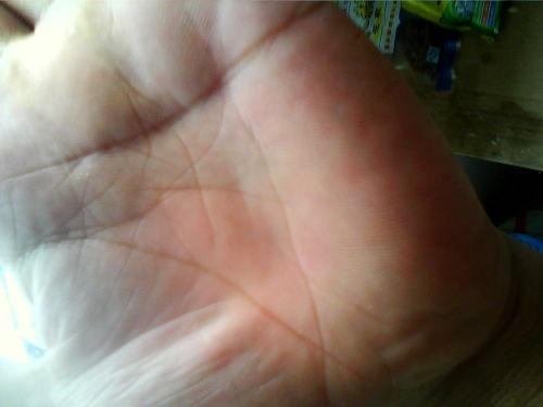 我手相里有金元宝 有图片 谁帮我算算啊