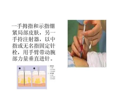 肌肉注射ppt