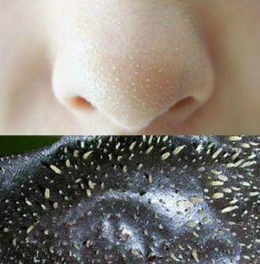 但是很多人由于买的去黑头的鼻贴质量不怎么好,效果不怎么样.