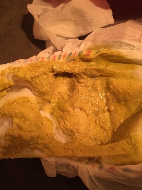 宝宝这几天有点拉肚子 大便颜色绿还有黏液怎么回事