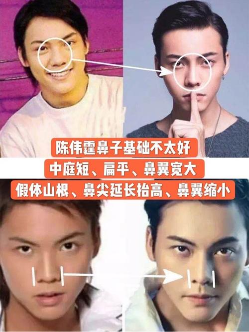 左边画个双眼皮 右边加个鼻假体 上周陈伟霆演绎了2019神曲《野狼