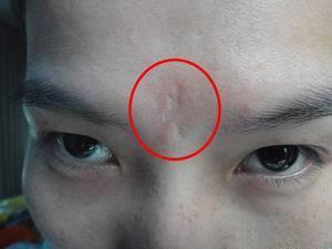 从面相印堂看你祸福吉凶,是好运还是霉运?