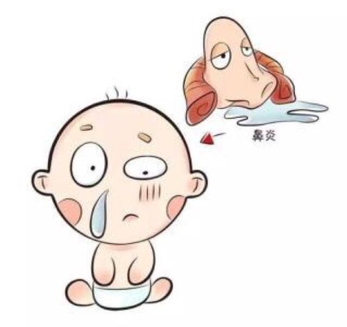 教你一招识别过敏性鼻炎,护理方法也请收好