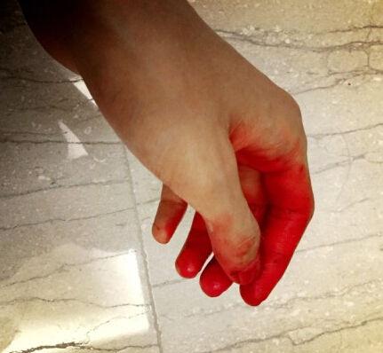 许嵩晒"血"手照 网友调侃:姨妈来了