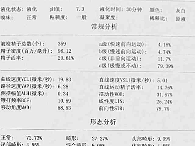精子常规报告主要看哪几个数值最重要