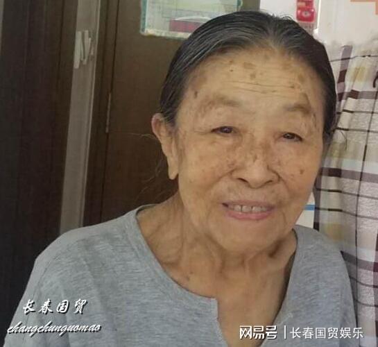 "丑娘"张少华去世,生前住院照片曝光,瘦骨嶙峋仍面带微笑