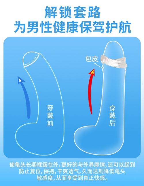取悦c型包皮阻复环包皮环私房乐凝胶包皮环系列酷客