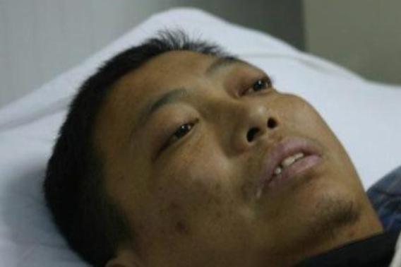 是因为老赵已经出现了明显的肝病面容,脸色发黄,口唇无力,结合老赵有