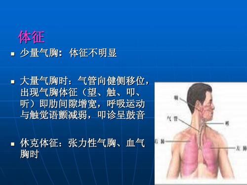 触,叩, 听)即肋间隙增宽,呼吸运动 与触觉语颤减弱,叩诊呈鼓音 休克