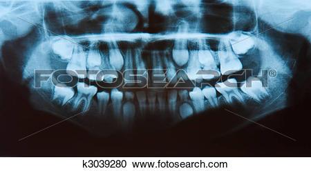 摄影图库 - 全景, 牙齿的x光, 全部, 牙齿, 在, 观点.