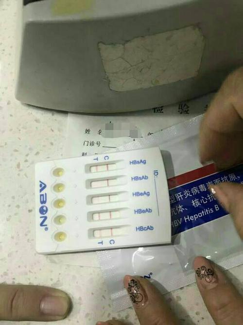 请问从乙肝五项的试纸,能看出小三阳的具体的一些情况吗?