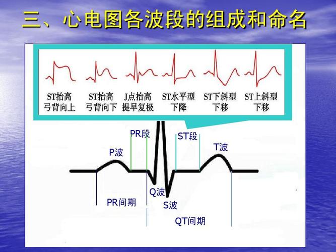 心电图基础知识课件