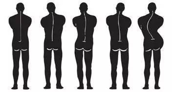 我14岁,有一点点驼背和高低肩,我爸就带我去那些中医按摩那治疗,去