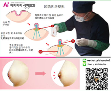其实适当的乳头外观也更能陪衬出丰满乳房的美.