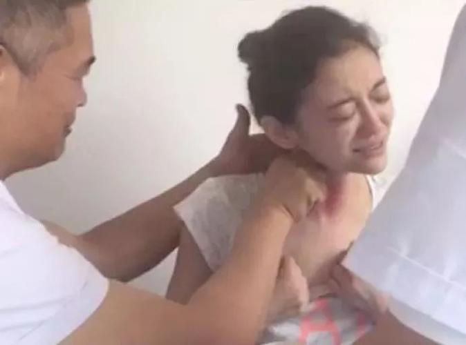 大夫在徐婷的脖子上"揪痧"