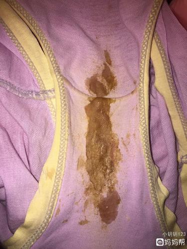 突然有点褐色的分泌物,这是怎么了?现在又