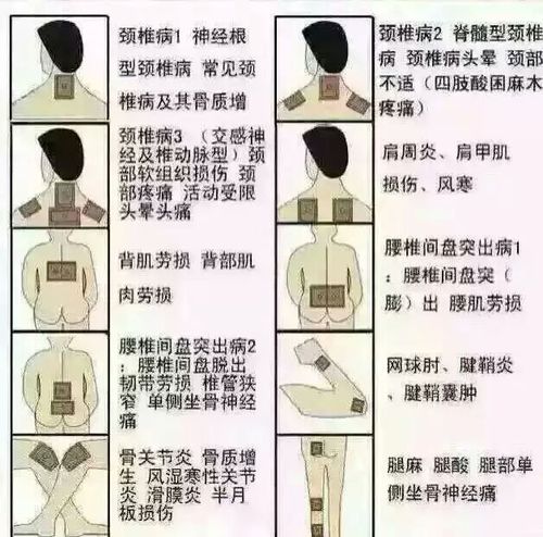 老倪膏药的【用法用量】:将患处洗净,将膏贴贴于疼痛部位和发病部位