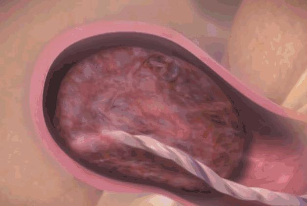 顺产为什么疼痛难忍三张图带你看顺产分娩全过程心疼各位宝妈