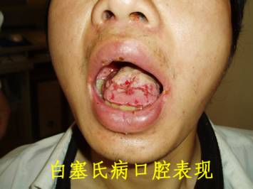 首页 冰雪  创办于1978年的河南少林塔沟武术学校在国内早已经是"战绩