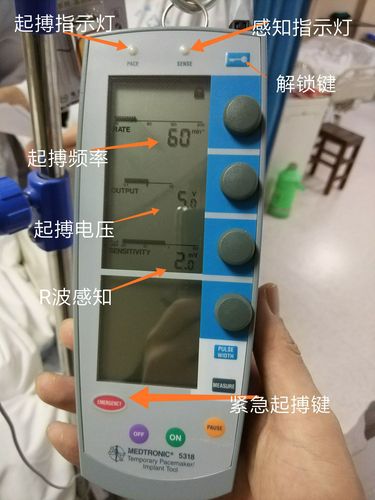 临时起搏器的电池更换