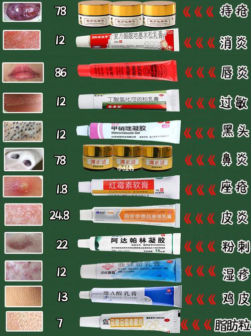 毛周角化——水杨酸软膏_软膏_药膏_凝胶_皮炎_鼻炎_鸡皮_好物分享