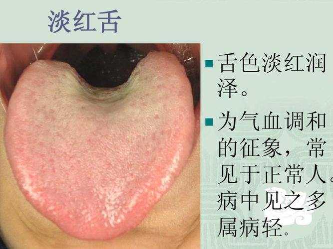 中医舌诊图文ppt
