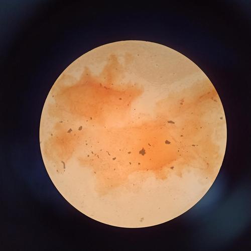 用显微镜观察各种菌