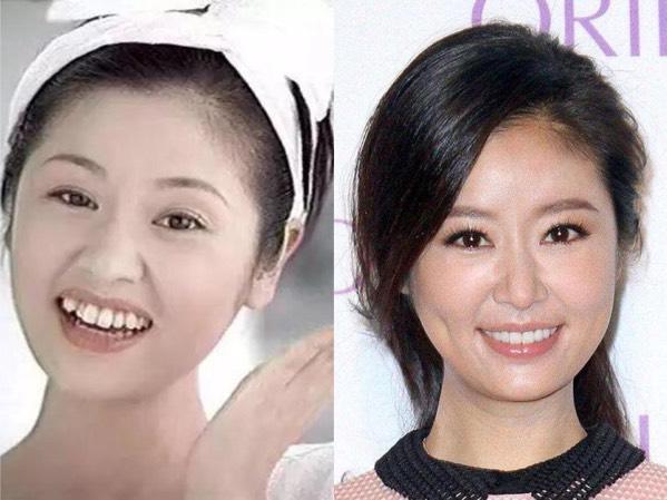 明星整牙前后的对比,堪比整容,看完你就知道牙齿有多么重要