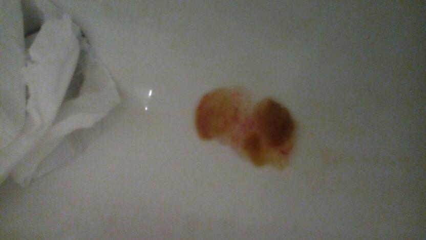 我一直有肠胃病,可就是不知道是怎么回事.