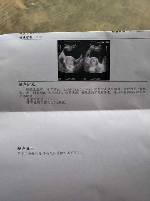 好孕帮显示怀孕四周加6,彩超结果如图,正常吗?好担心.