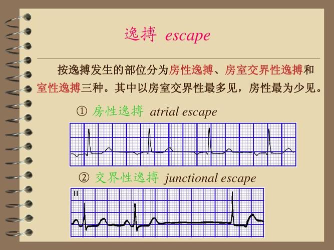 my常规心电图简介2ppt