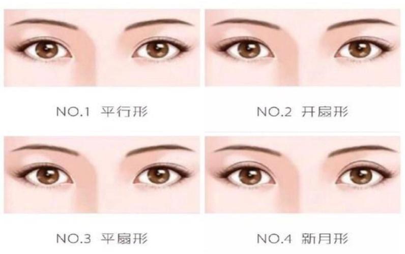 现在有很多人都想要做双眼皮,可是你了解过双眼皮类型