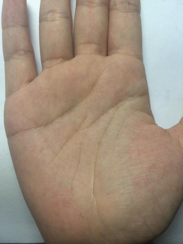 请问这是智慧线分叉还是断裂?有什么含义?手相综合怎样?