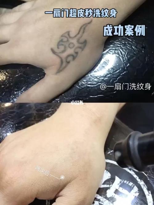 超皮秒洗纹身,不留疤_纹身_超皮秒_一扇门刺青·纹身·洗纹身自由行
