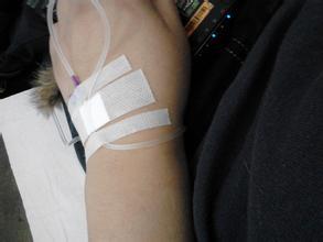 手上打针的图片