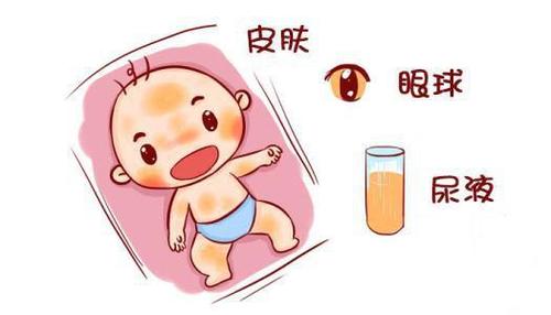 试试这2个退黄疸的