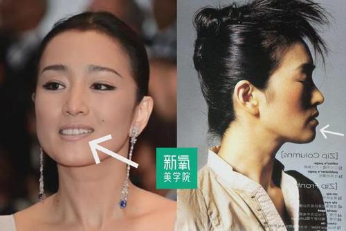 关晓彤的嘟囔下巴照这个古典路子走能封神