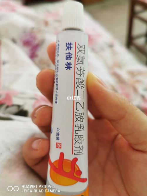 腱鞘炎(妈妈手)缓解方法_药膏_扶他林怎么样_南京宝妈