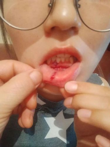 网传巴中某副局长医院打人?事件详细经过是这样的