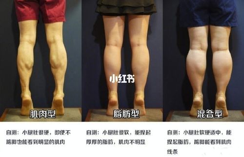 教你判断是肌肉型,还是脂肪混合型小腿?