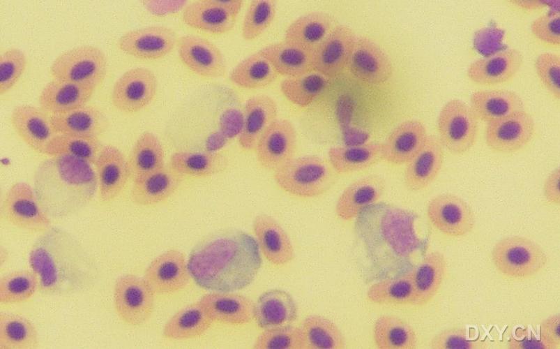 [讨论]鱼血细胞的染色