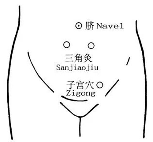 子宫穴定位于在下腹部,当脐中下4寸,中极旁开3寸,有调理女性月经之效.