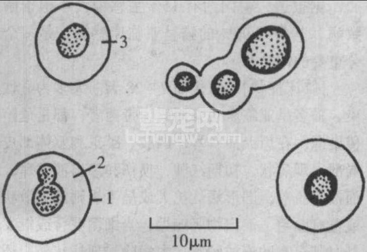 图3-4-3 新型隐球菌
