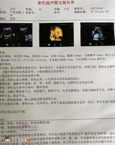 宝宝的四维照片来喽孕24周772了已知是男宝宝