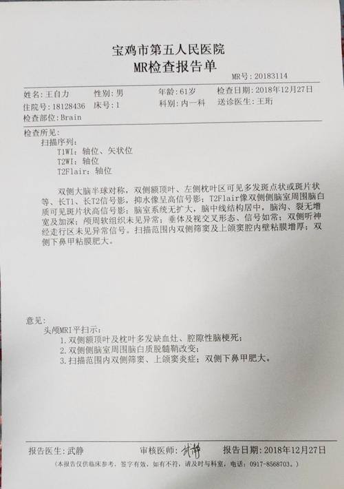 头部ct报告单