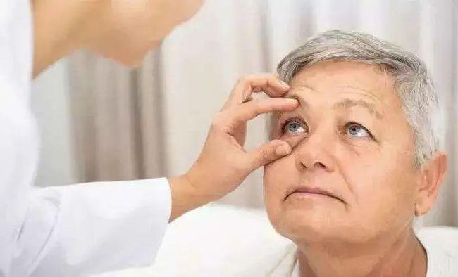 眼睛干涩模疼痛有救了!每天1粒,不用再滴眼药水!