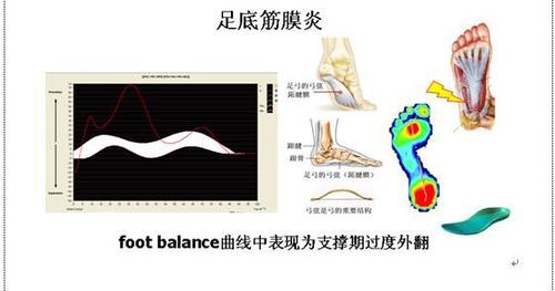 足底压力测试对于足踝疾病诊断和治疗的意义