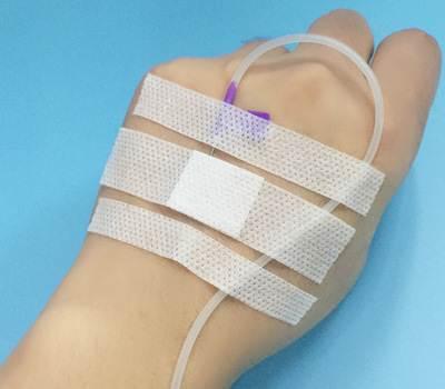 医用输液贴吊针吊瓶医用胶布透气防过敏打点滴胶贴200